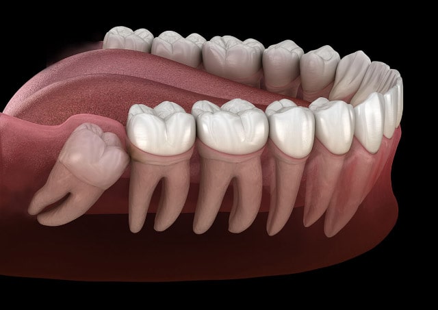 dente del giudizio