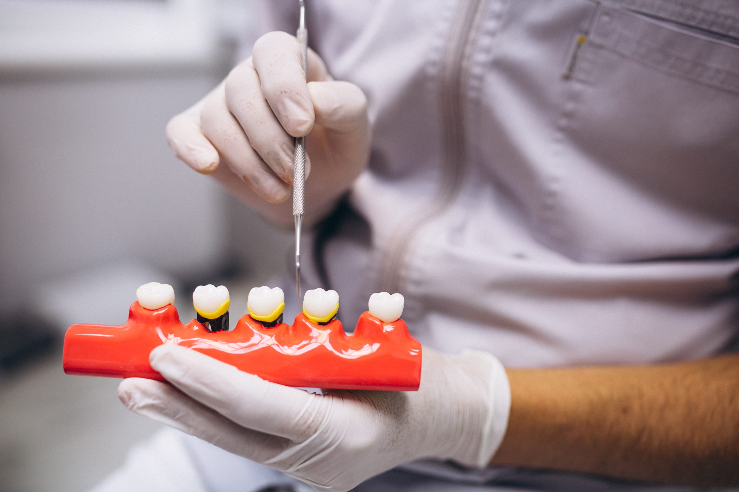 Valutazione odontoiatrica della salute orale