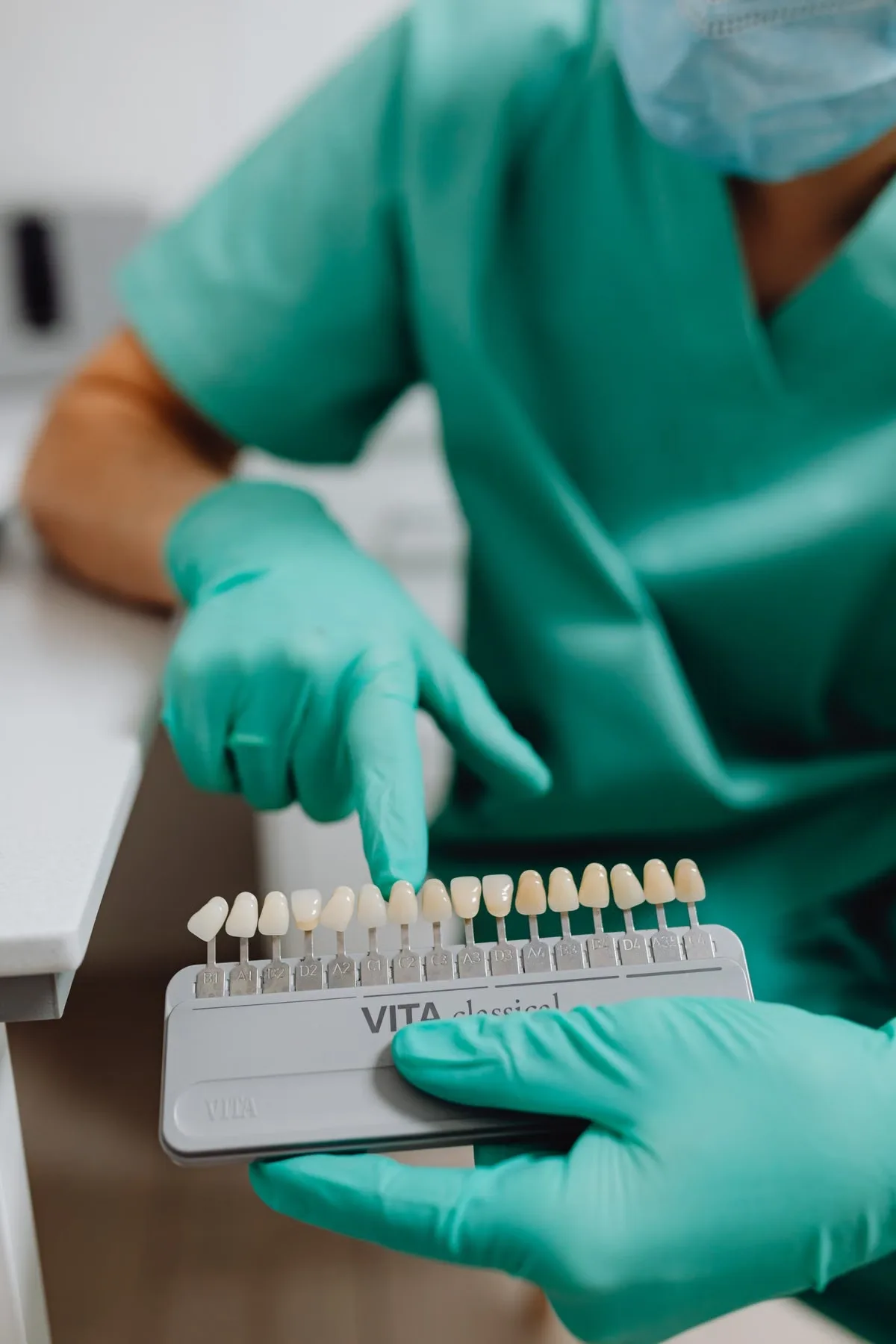 Valutazione del colore dentale mediante guida colore
